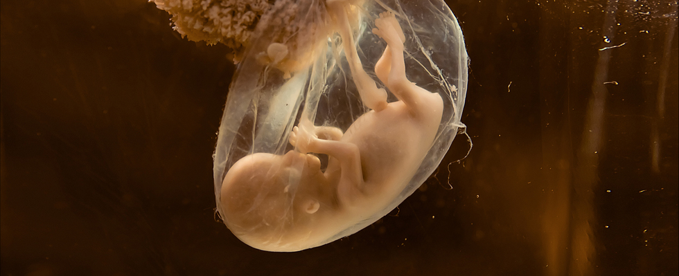 The Ethics of Monkey-Human Embryos