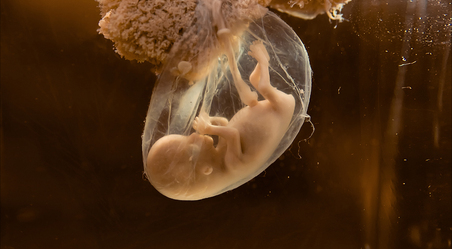 The Ethics of Monkey-Human Embryos